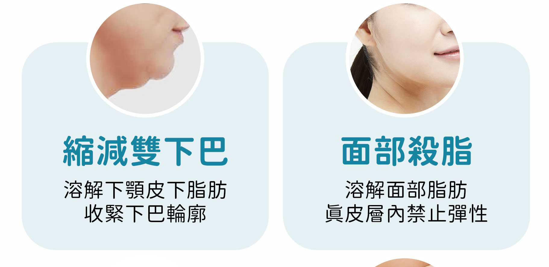 ONDA縮減雙下巴 溶解下颚脂肪 收緊下巴輪廓 面部溶脂緊緻