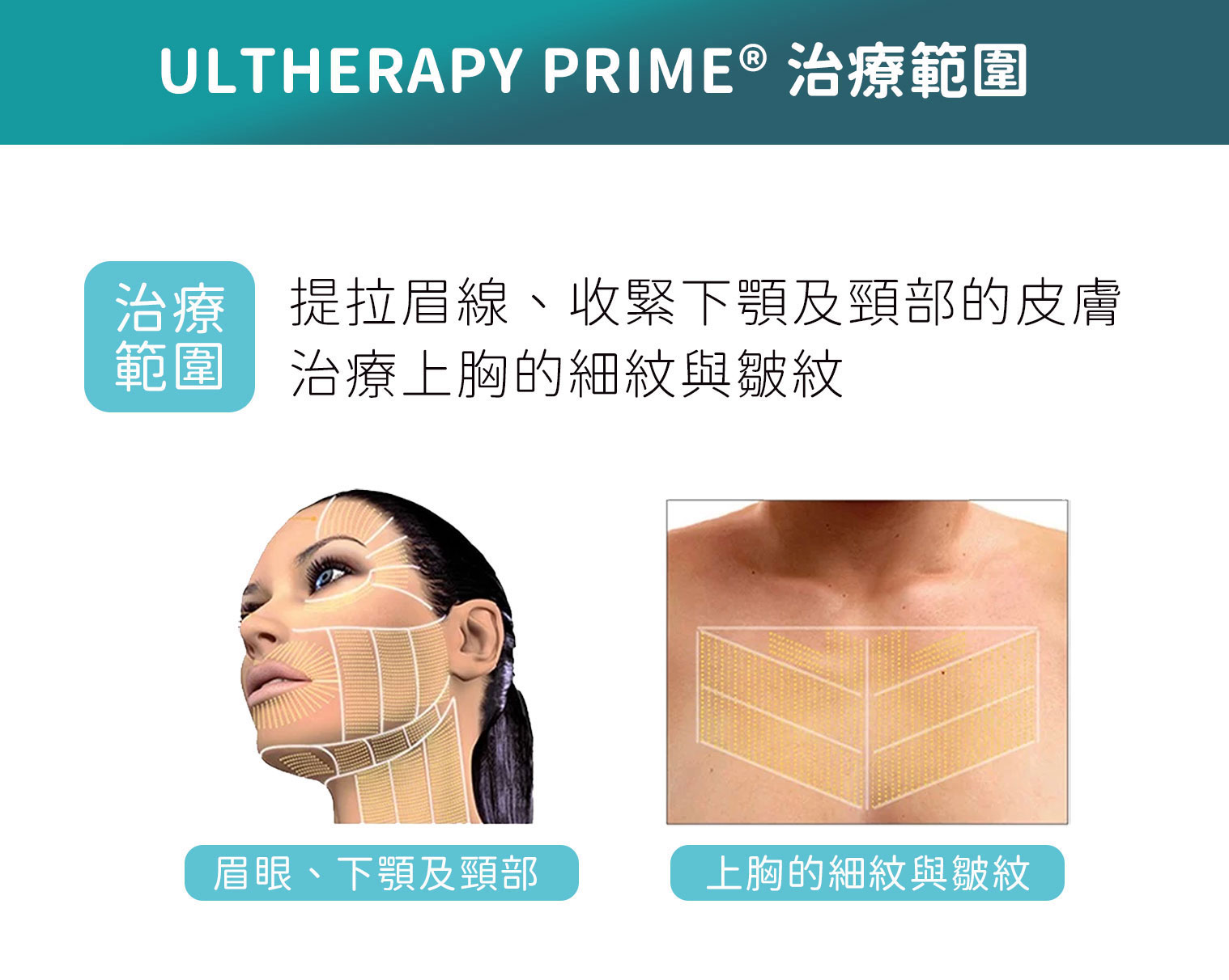ULTHERAPY PRIME 治療範圍：提拉眉線、收緊下顎及頸部皮膚，改善上胸細紋與皺紋